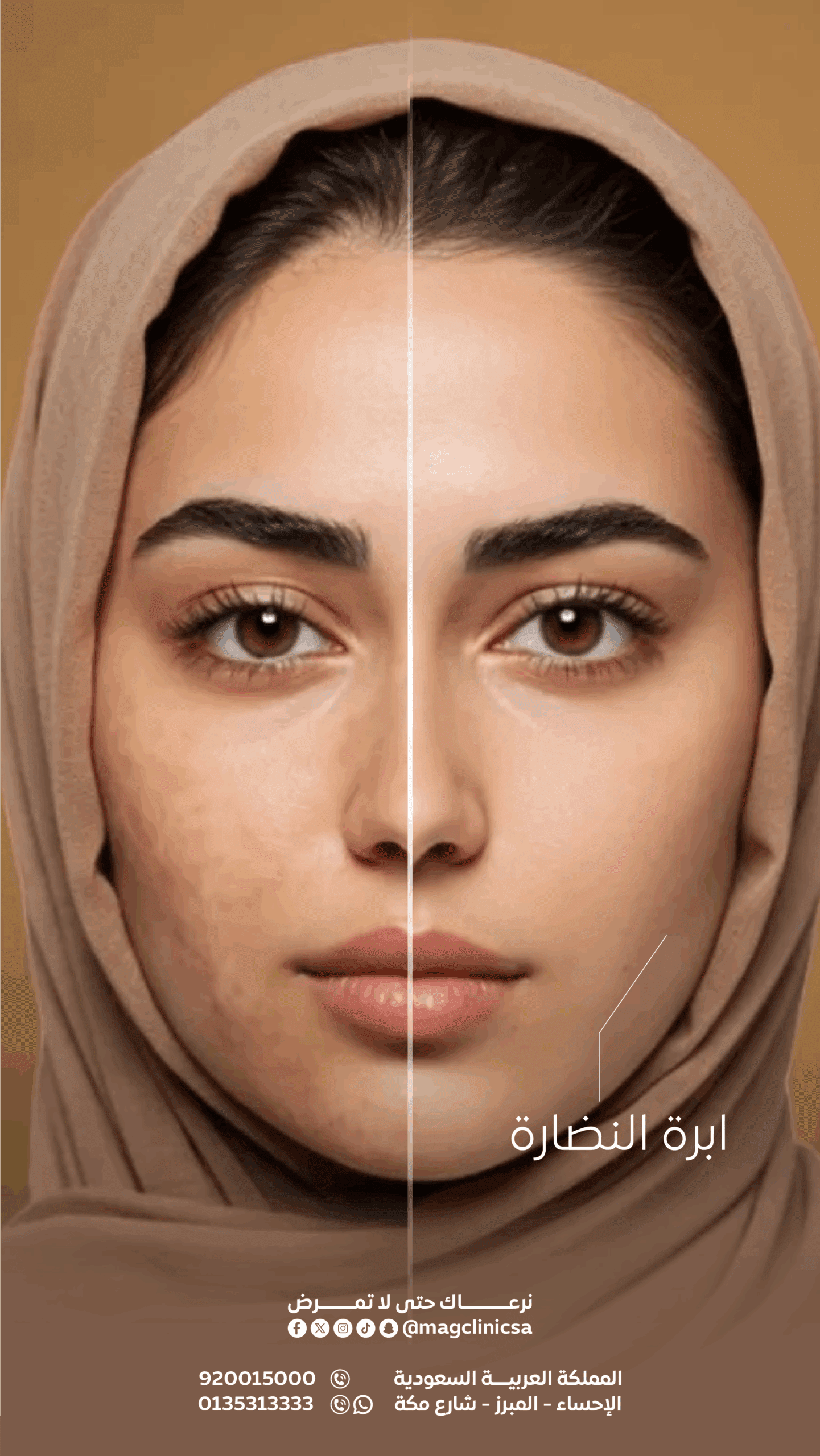 نضارة B&A