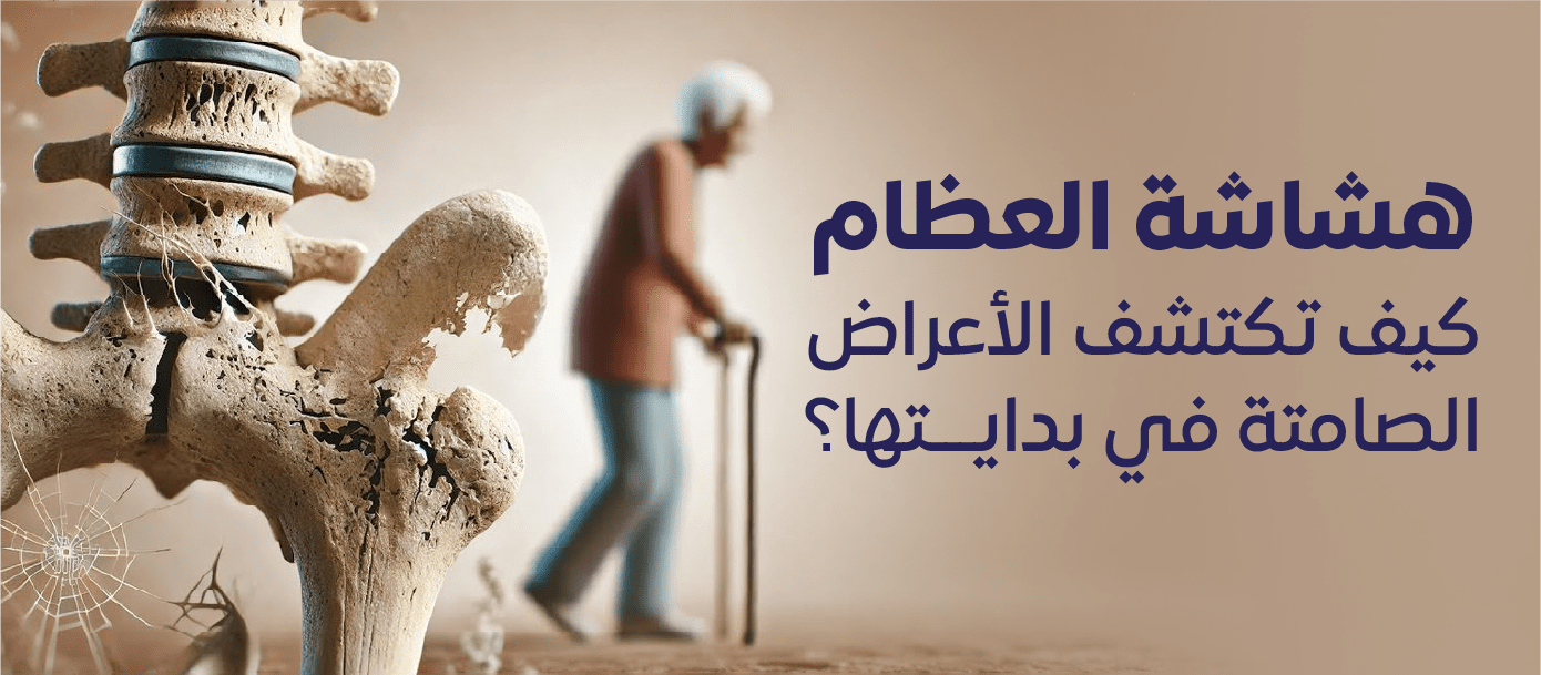 الأعراض الصاكتة لهشاشة العظام