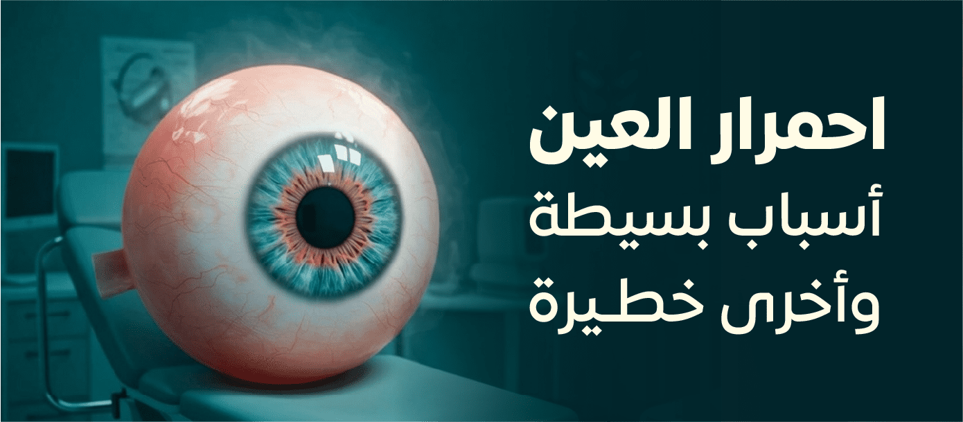 تصميم توضيحي لعين مصابة بالاحمرار يوضح الفرق بين الأسباب البسيطة والخطيرة في مجمع المغلوث الطبي في المبرز.