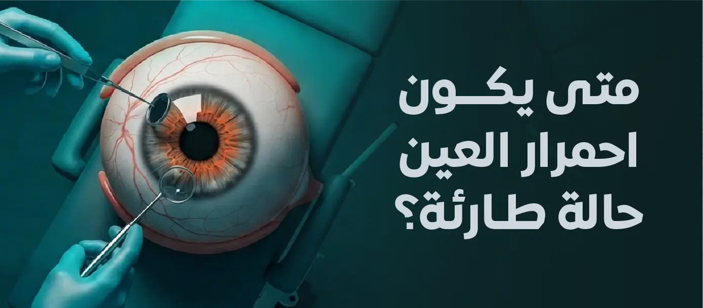 متى يكون احمرار العين حالة طارئة مع توضيح علامات خطيرة مثل الألم وضعف الرؤية واحمرار العين الشديد