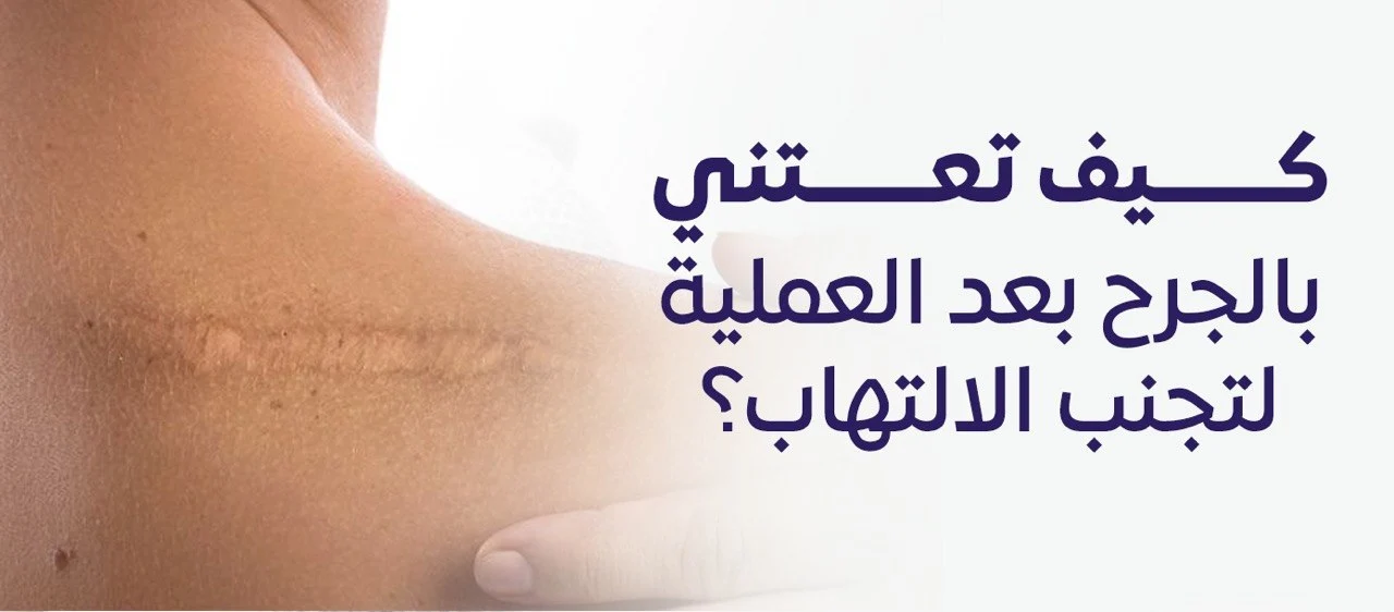 طريقة العناية بالجرح بعد العملية الجراحية لتجنب الالتهاب وتسريع الالتئام.