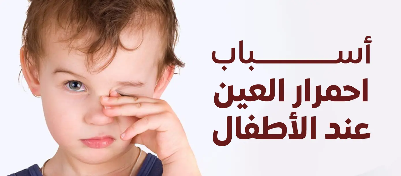 طفل يعاني من احمرار العين ويقوم بفركها، ضمن مقال يشرح أسباب احمرار العين عند الأطفال ومتى تستدعي الحالة مراجعة طبيب العيون.