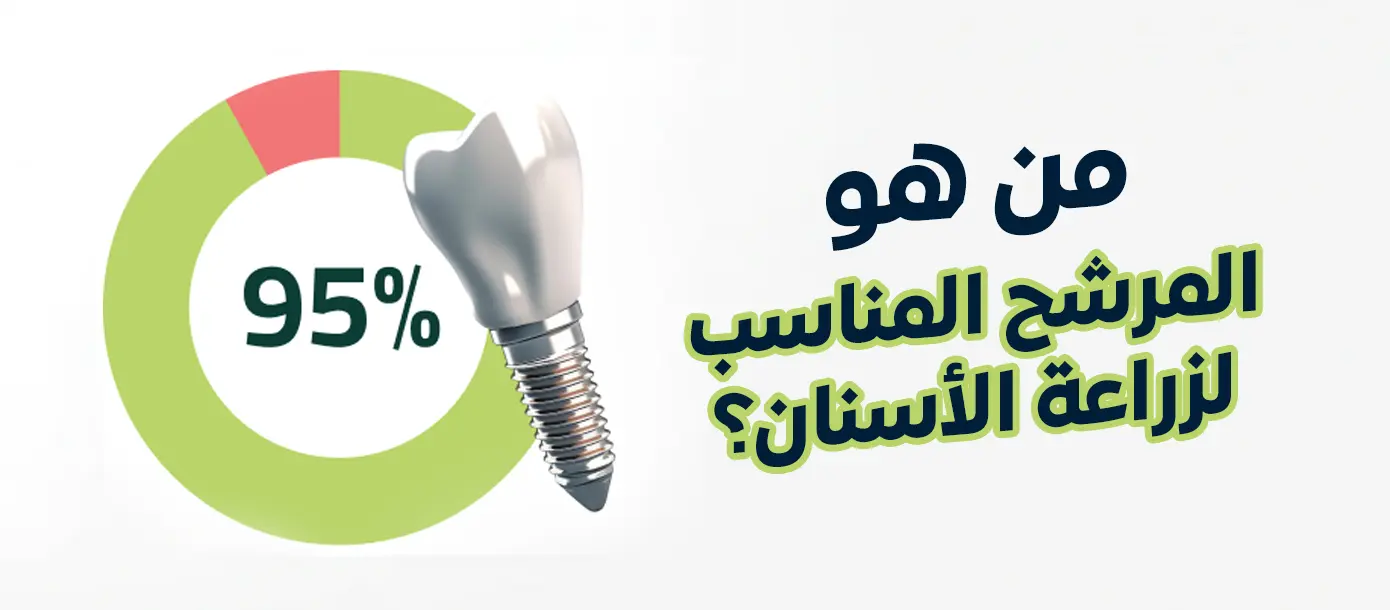 من هو المرشح المناسب لزراعة الأسنان؟