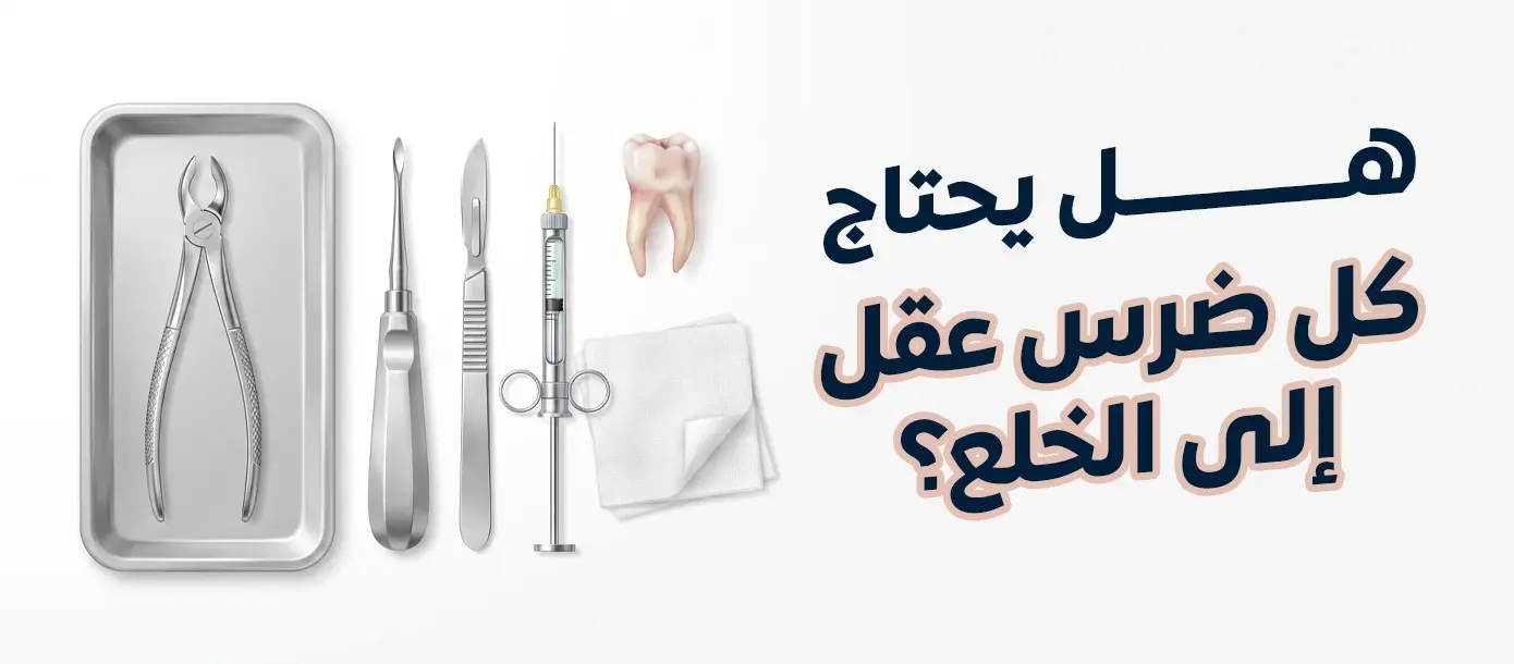 هل يحتاج كل ضرس عقل إلى الخلع؟