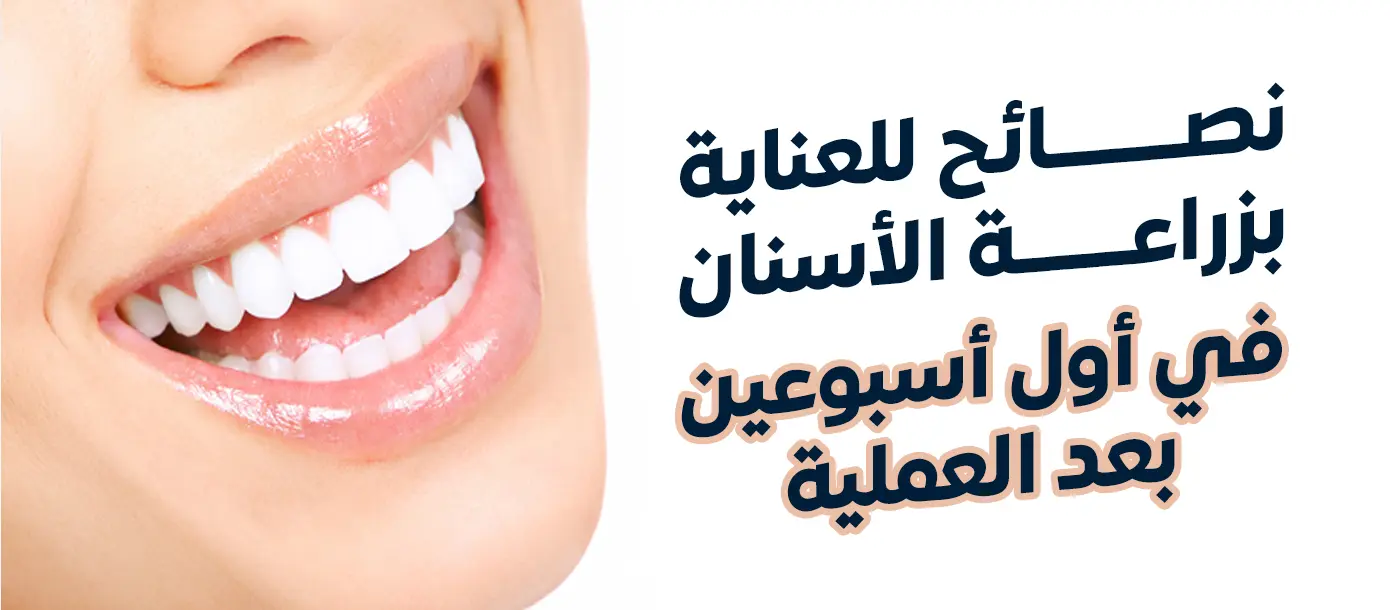 نصائح للعناية بزراعة الأسنان بعد العملية خلال أول أسبوعين