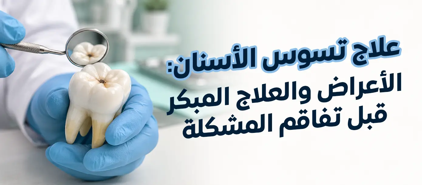علاج تسوس الأسنان والتعرف على مراحل التسوس وطرق ترميم السن المتضرر